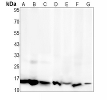 MIF Rabbit Monoclonal Antibody