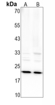 BID Rabbit Monoclonal Antibody