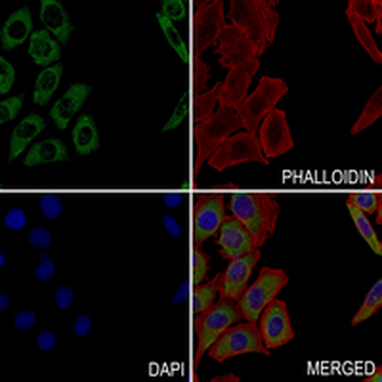 BID Rabbit Monoclonal Antibody