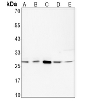 BCL2 Rabbit Monoclonal Antibody