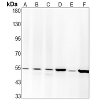 Parkin Rabbit Monoclonal Antibody