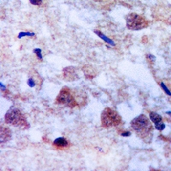 Parkin Rabbit Monoclonal Antibody
