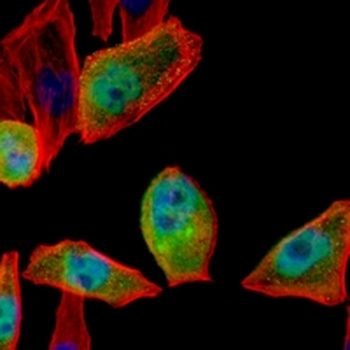 Parkin Rabbit Monoclonal Antibody
