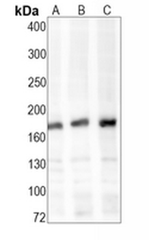CD206 Rabbit Monoclonal Antibody