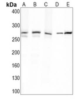 FASN Rabbit Monoclonal Antibody