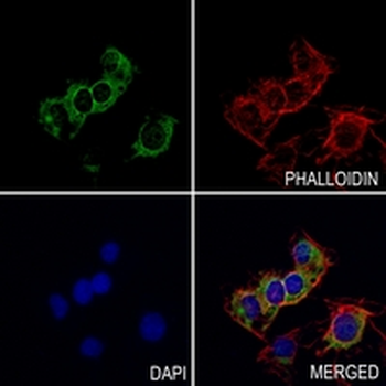 FASN Rabbit Monoclonal Antibody