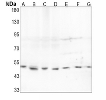 PTP1B Rabbit Monoclonal Antibody
