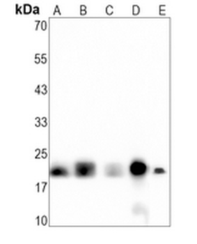 4EBP1 Rabbit Monoclonal Antibody
