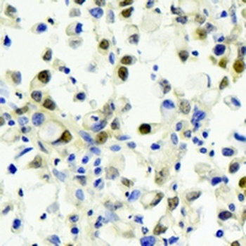 4EBP1 Rabbit Monoclonal Antibody