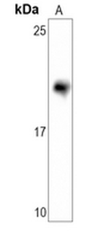 CD3d Rabbit Monoclonal Antibody