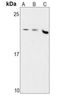 MGMT Rabbit Monoclonal Antibody
