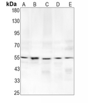 ATF4 Rabbit Monoclonal Antibody