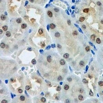 ATF4 Rabbit Monoclonal Antibody