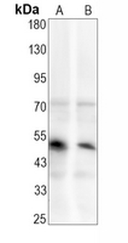 SMAD1/5/9 (Phospho-S463/S465) Rabbit Monoclonal Antibody