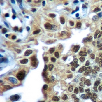 RB1 Rabbit Monoclonal Antibody