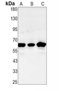 CHK2 Rabbit Monoclonal Antibody