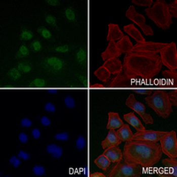 CHK2 Rabbit Monoclonal Antibody