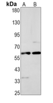 Tyrosine Hydroxylase Rabbit Monoclonal Antibody