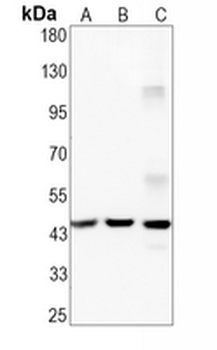 CABP1 Rabbit Monoclonal Antibody