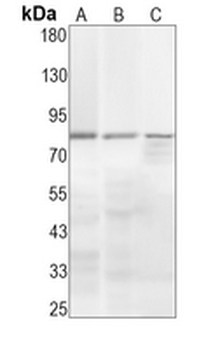 Transferrin Rabbit Monoclonal Antibody