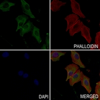 Transferrin Rabbit Monoclonal Antibody