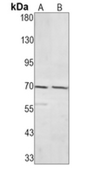 Caldesmon Rabbit Monoclonal Antibody