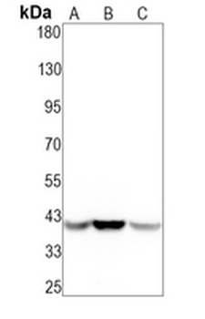 alpha-Actin Rabbit Monoclonal Antibody