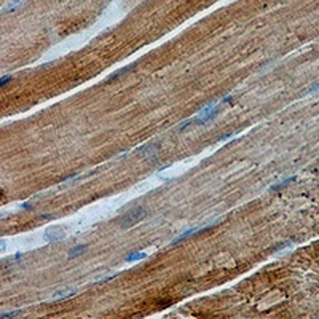 alpha-Actin Rabbit Monoclonal Antibody