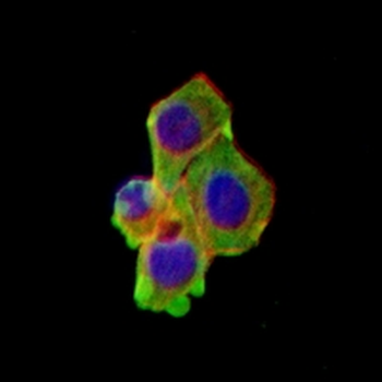 alpha-Actin Rabbit Monoclonal Antibody