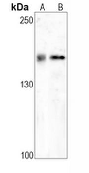 EGFR Rabbit Monoclonal Antibody