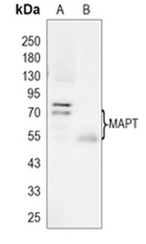 TAU Rabbit Monoclonal Antibody