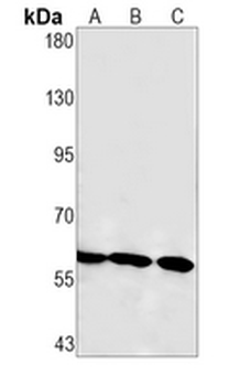 SMAD4 Rabbit Monoclonal Antibody