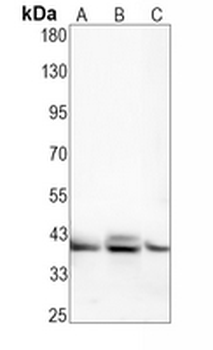 CD32 Rabbit Monoclonal Antibody