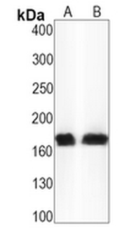 LRP6 (Phospho-S1490) Rabbit Monoclonal Antibody
