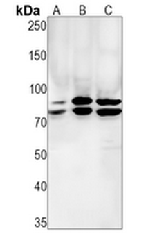DDX17 Rabbit Monoclonal Antibody