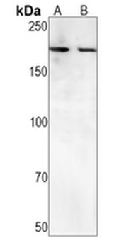 ATAD2 Rabbit Monoclonal Antibody