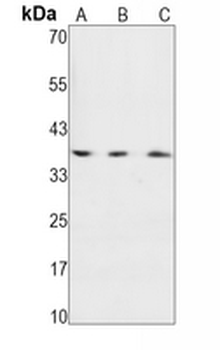 IKB alpha (Phospho-S36) Rabbit Monoclonal Antibody
