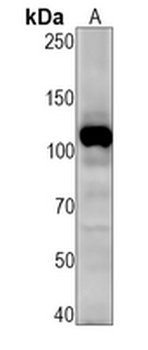 PI3K p110 delta Rabbit Monoclonal Antibody
