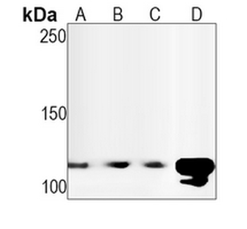 CD62P Rabbit Monoclonal Antibody