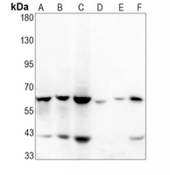 CD147 Rabbit Monoclonal Antibody