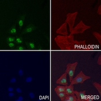 CD147 Rabbit Monoclonal Antibody