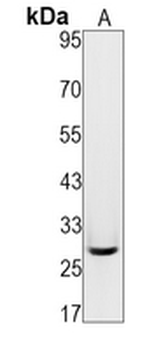 CD99 Rabbit Monoclonal Antibody