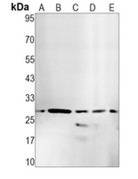 Caspase 14 Rabbit Monoclonal Antibody