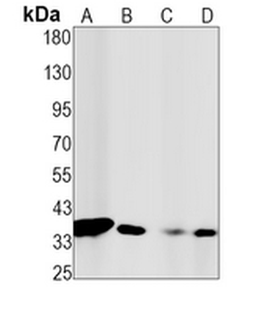 CDC34 Rabbit Monoclonal Antibody