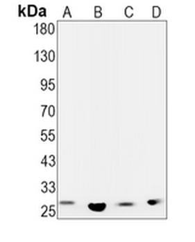 CDCA3 Rabbit Monoclonal Antibody