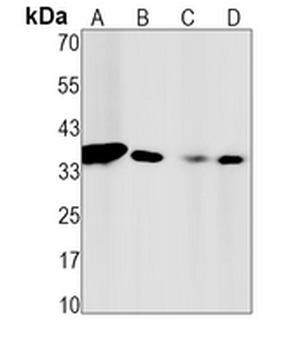 Caspase 6 Rabbit Monoclonal Antibody