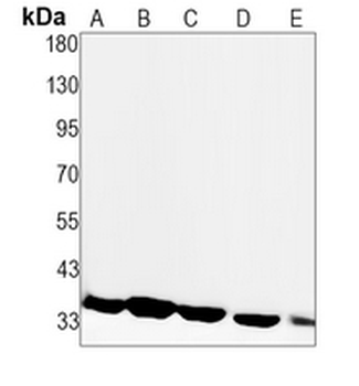 CDK4 Rabbit Monoclonal Antibody