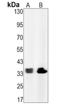 CDK2 (Phospho-Y15) Rabbit Monoclonal Antibody