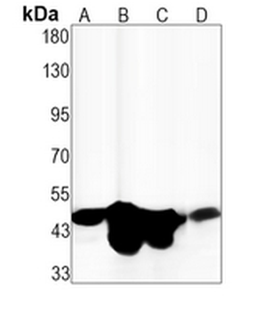 CD38 Rabbit Monoclonal Antibody
