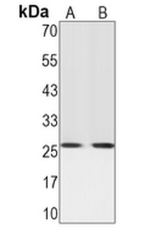 CD81 Rabbit Monoclonal Antibody